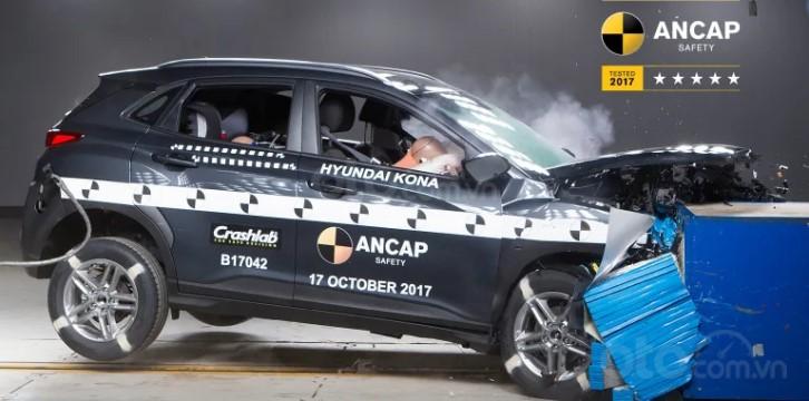 Hyundai phát triển công nghệ AI chẩn đoán tổn thương của người lái..